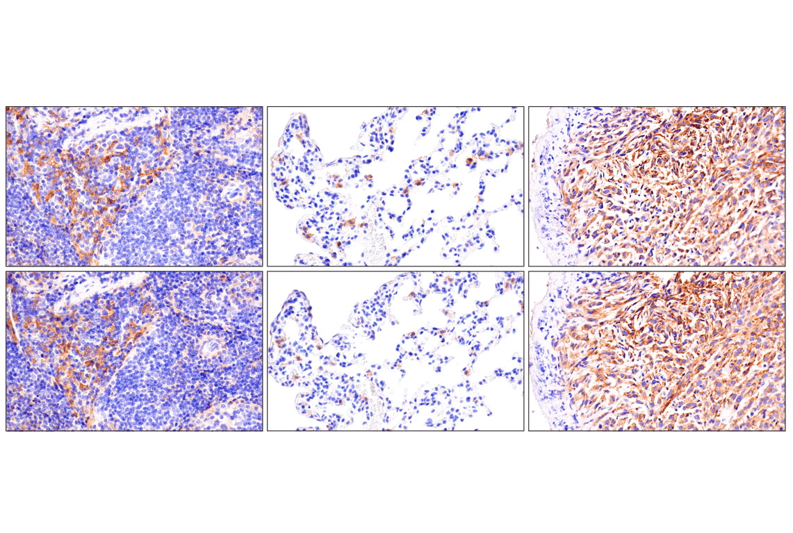Immunohistochemistry Image 6: Axl (E3Z2H) Rabbit mAb