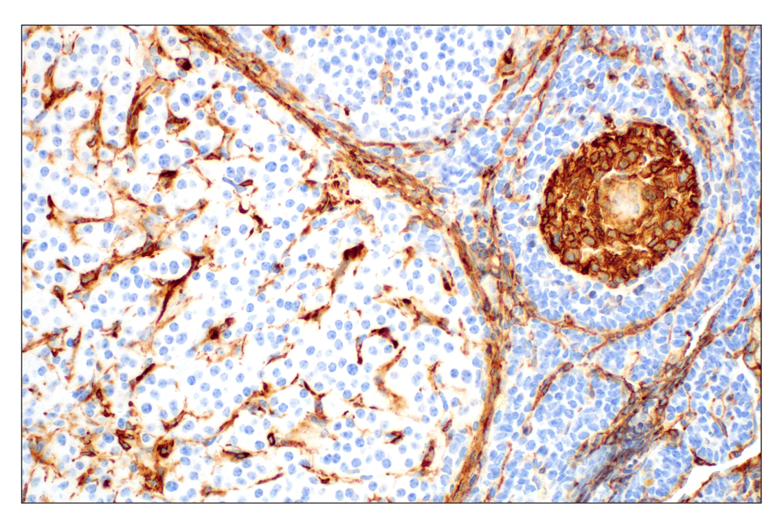 Immunohistochemistry Image 6: α-Smooth Muscle Actin (1A4) Mouse mAb (BSA and Azide Free)