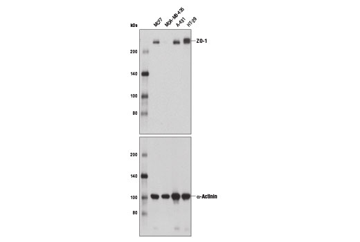 undefined Image 5: Epithelial-Mesenchymal Transition (EMT) IF Antibody Sampler Kit