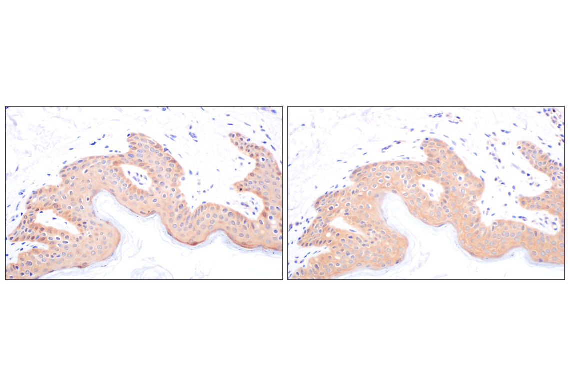 Immunohistochemistry Image 10: Galectin-8/LGALS8 (F9O3T) Rabbit mAb