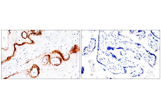 Immunohistochemistry Image 1: SARS-CoV-2 Spike Protein (S1) (E5S3V) Rabbit mAb