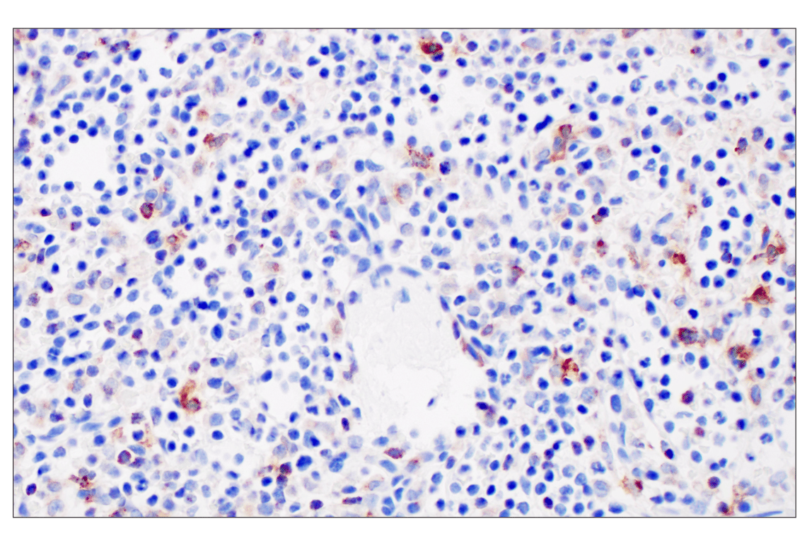 Immunohistochemistry Image 10: HLA-DRA (E9R2Q) XP<sup>®</sup> Rabbit mAb