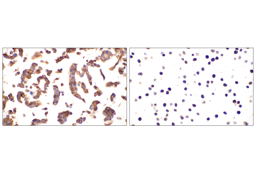 Immunohistochemistry Image 2: Glut1 (E4S6I) Rabbit mAb