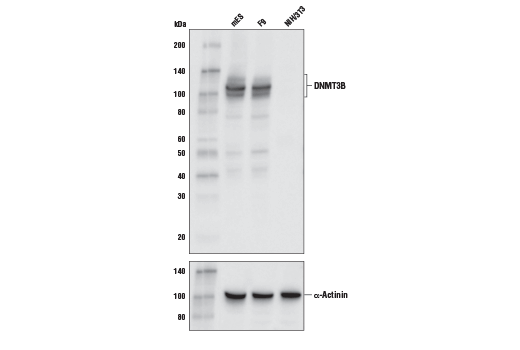 Western Blotting Image 1: DNMT3B (E4I4O) Rabbit mAb