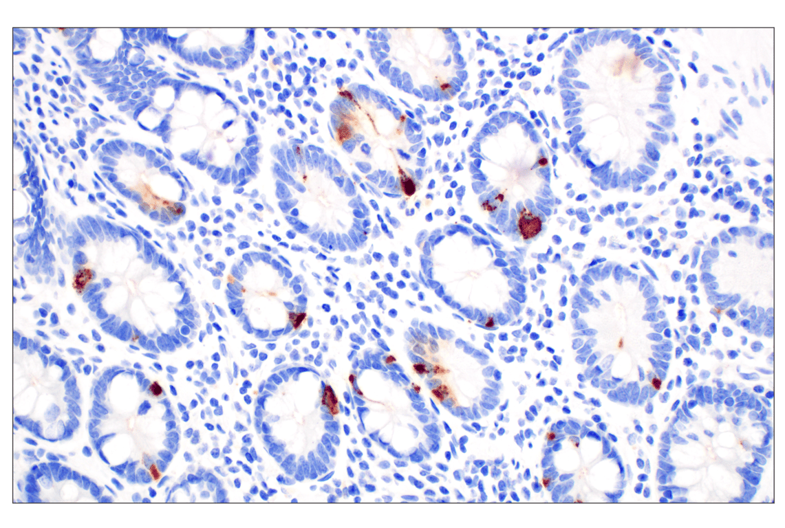 Immunohistochemistry Image 3: CHGA (F7D6H) Rabbit mAb (BSA and Azide Free)