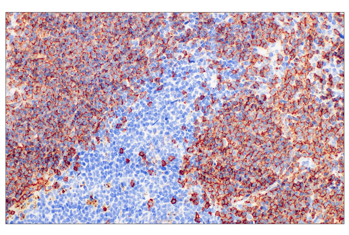 Immunohistochemistry Image 1: CD20 (E3N7O) XP<sup>®</sup> Rabbit mAb
