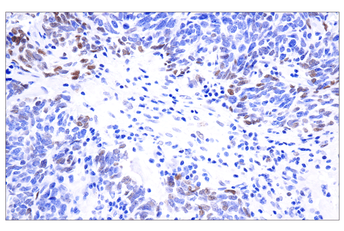 undefined Image 35: ALK Activation Antibody Sampler Kit