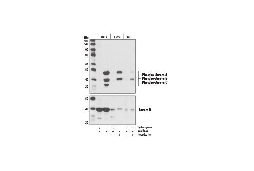 Western Blotting Image 1: Phospho-Aurora A (Thr288)/Aurora B (Thr232)/Aurora C (Thr198) (D13A11) XP<sup>®</sup> Rabbit mAb