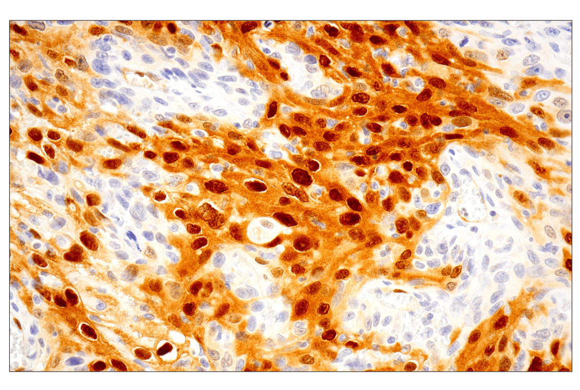 Immunohistochemistry Image 2: Phospho-p44/42 MAPK (Erk1/2) (Thr202/Tyr204) (D13.14.4E) XP<sup>®</sup> Rabbit mAb