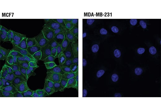 Identification of ZBTB18 as a novel colorectal tumor