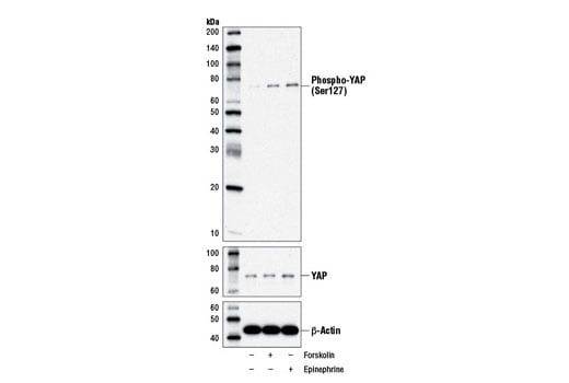 Western Blotting Image 3: Phospho-YAP (Ser127) (D9W2I) Rabbit mAb