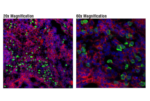 Immunofluorescence Image 2: S100A9 (D3U8M) Rabbit mAb
