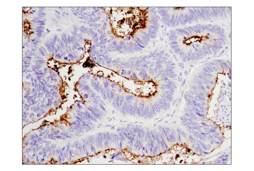 Immunohistochemistry Image 2: CD133 (D2V8Q) XP<sup>®</sup> Rabbit mAb (BSA and Azide Free)