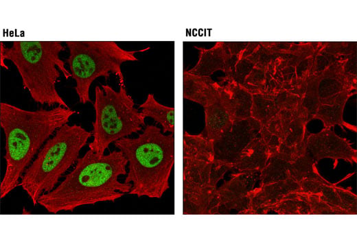 undefined Image 52: BAF Complex IHC Antibody Sampler Kit