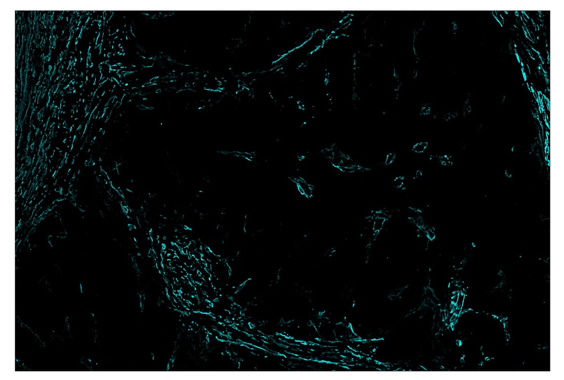 Immunohistochemistry Image 6: α-Smooth Muscle Actin (D4K9N) & CO-0024-488 SignalStar<sup>™</sup> Oligo-Antibody Pair