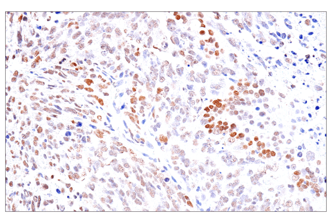 Immunohistochemistry Image 12: FoxA1/HNF3α (IHC578) Mouse mAb