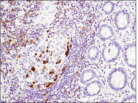 使用 CD19 (Intracellular Domain) (D4V4B) XP<sup>®</sup> Rabbit mAb 对石蜡包埋的人扁桃体细胞进行免疫组织化学分析。