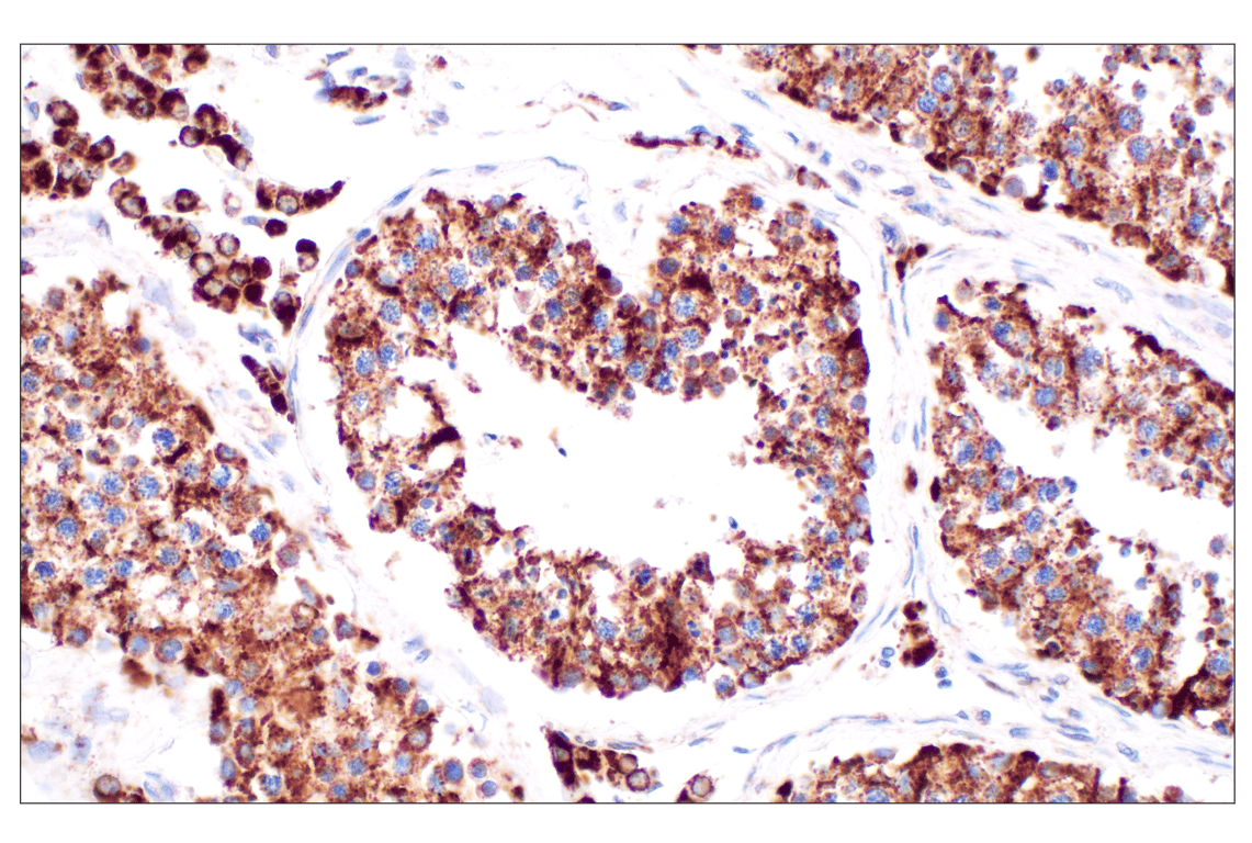 undefined Image 38: Cell Fractionation Antibody Sampler Kit