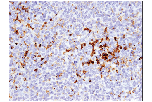 Immunohistochemistry Image 1: FcγRIIB (D8F9C) XP<sup>®</sup> Rabbit mAb