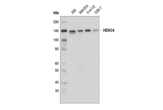 Class II HDAC Antibody Sampler Kit: Image 1