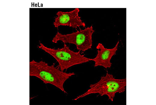 Immunofluorescence Image 1: PCNA (D3H8P) XP<sup>®</sup> Rabbit mAb 