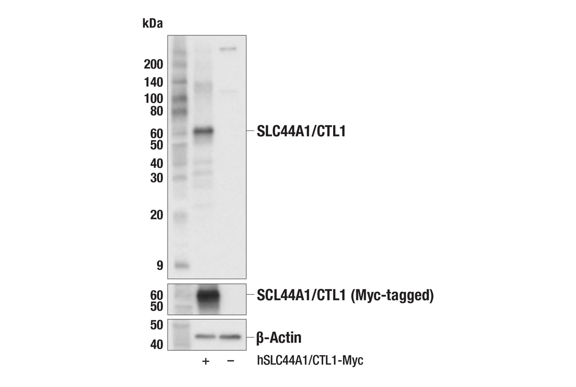 Western Blotting Image 3: SLC44A1 (F8D3V) Rabbit mAb