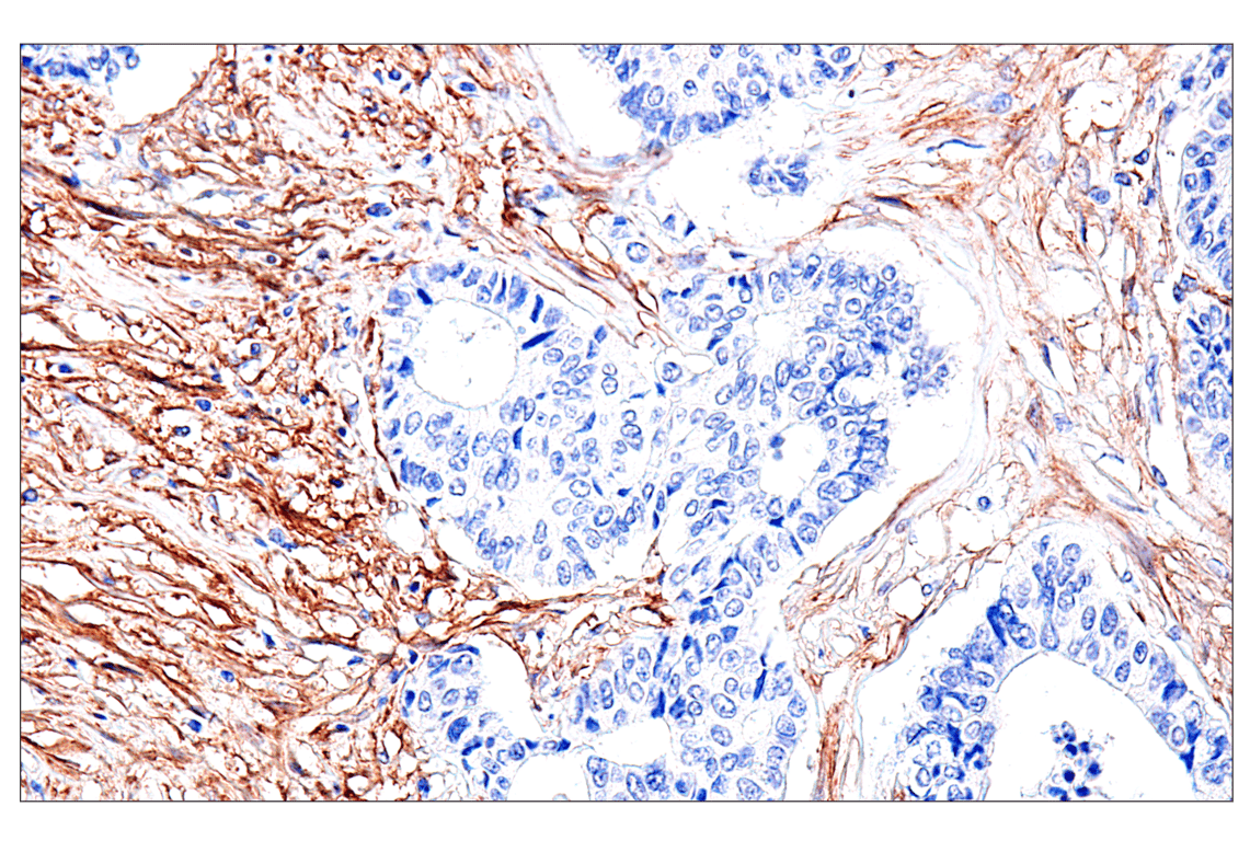 Immunohistochemistry Image 6: FAP (F1A4G) Rabbit mAb (BSA and Azide Free)