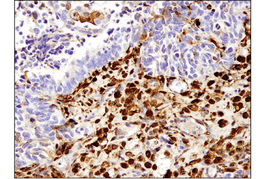 Immunohistochemistry Image 2: ALDH1A1 (D9Q8E) XP<sup>®</sup> Rabbit mAb (BSA and Azide Free)