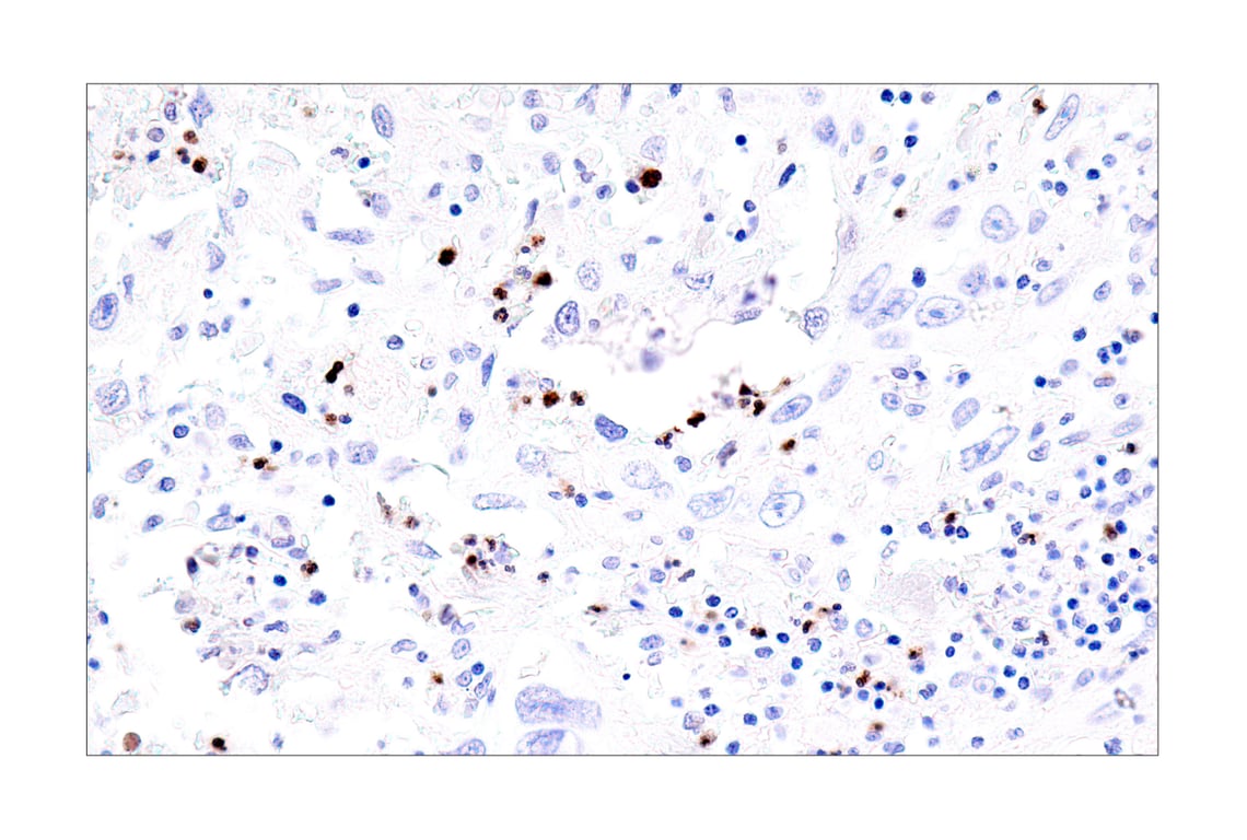 Immunohistochemistry Image 5: IL-8 (E5F5Q) XP<sup>®</sup> Rabbit mAb