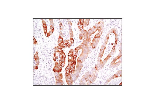 Immunohistochemistry Image 3: Keratin 17/19 (D32D9) XP<sup>®</sup> Rabbit mAb (BSA and Azide Free)