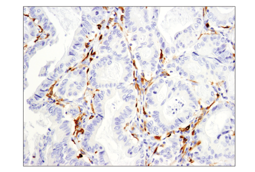 Immunohistochemistry Image 1: CD163 (D6U1J) Rabbit mAb (BSA and Azide Free)