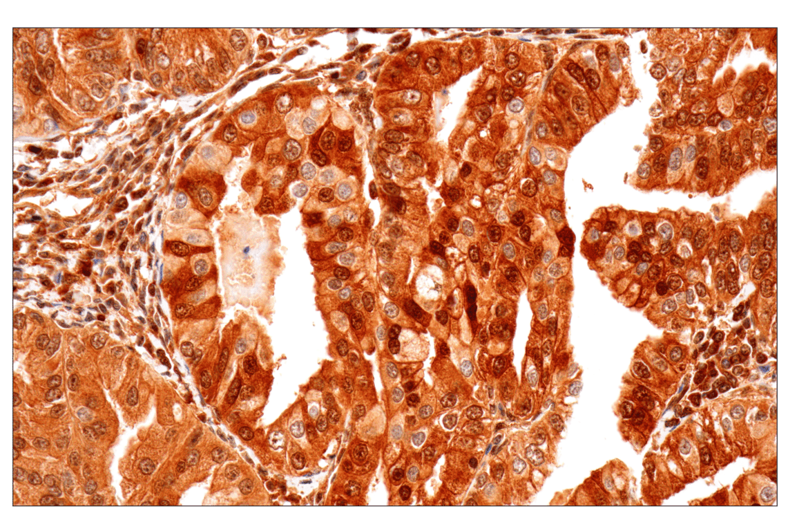 Immunohistochemistry Image 4: MTAP (E5R1I) Rabbit mAb (BSA and Azide Free)