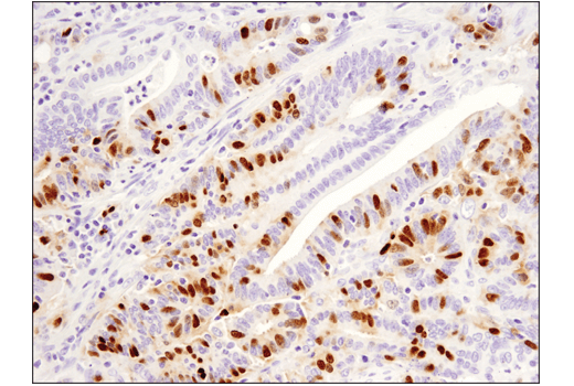 Immunohistochemistry Image 2: PAF15 (D8E2Y) XP<sup>®</sup> Rabbit mAb