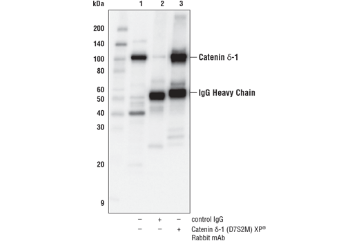 Immunoprecipitation Image 1: Catenin δ-1 (D7S2M) XP<sup>®</sup> Rabbit mAb