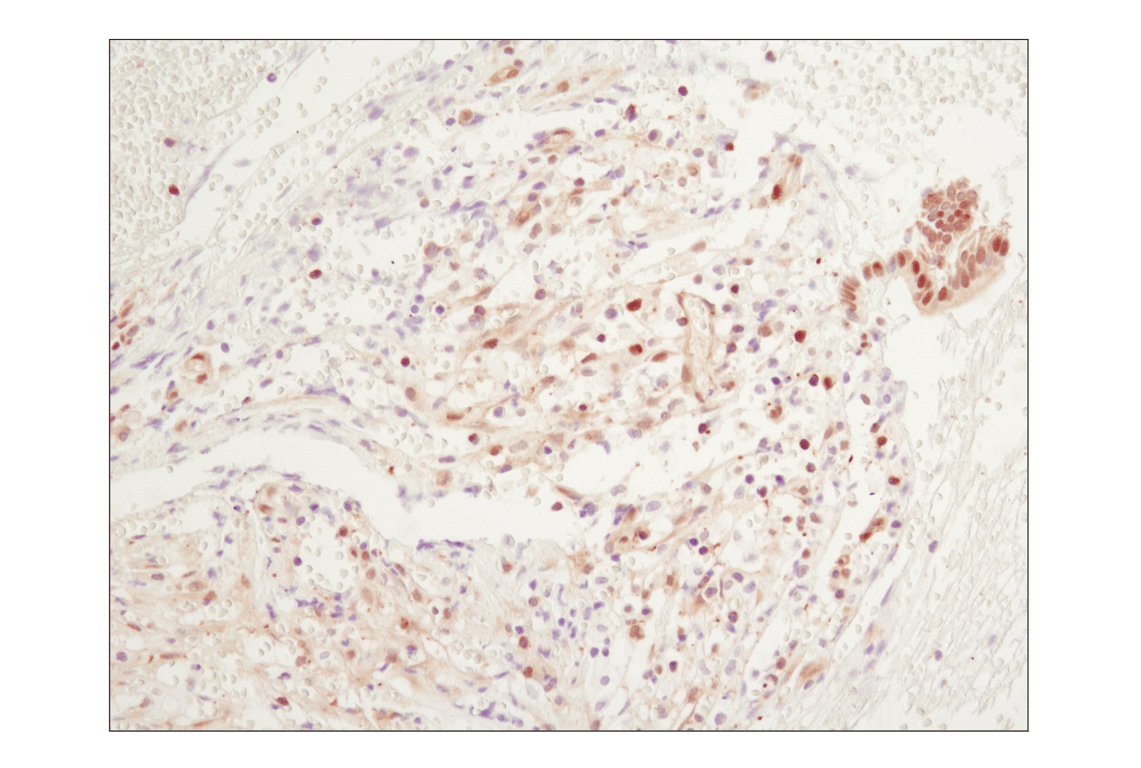 undefined Image 9: PhosphoPlus<sup>®</sup> NF-κB p65/RelA (Ser536) Antibody Duet