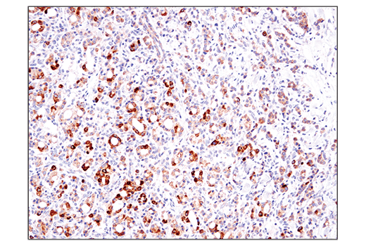 undefined Image 7: Branched-Chain Amino Acid Metabolism Antibody Sampler Kit