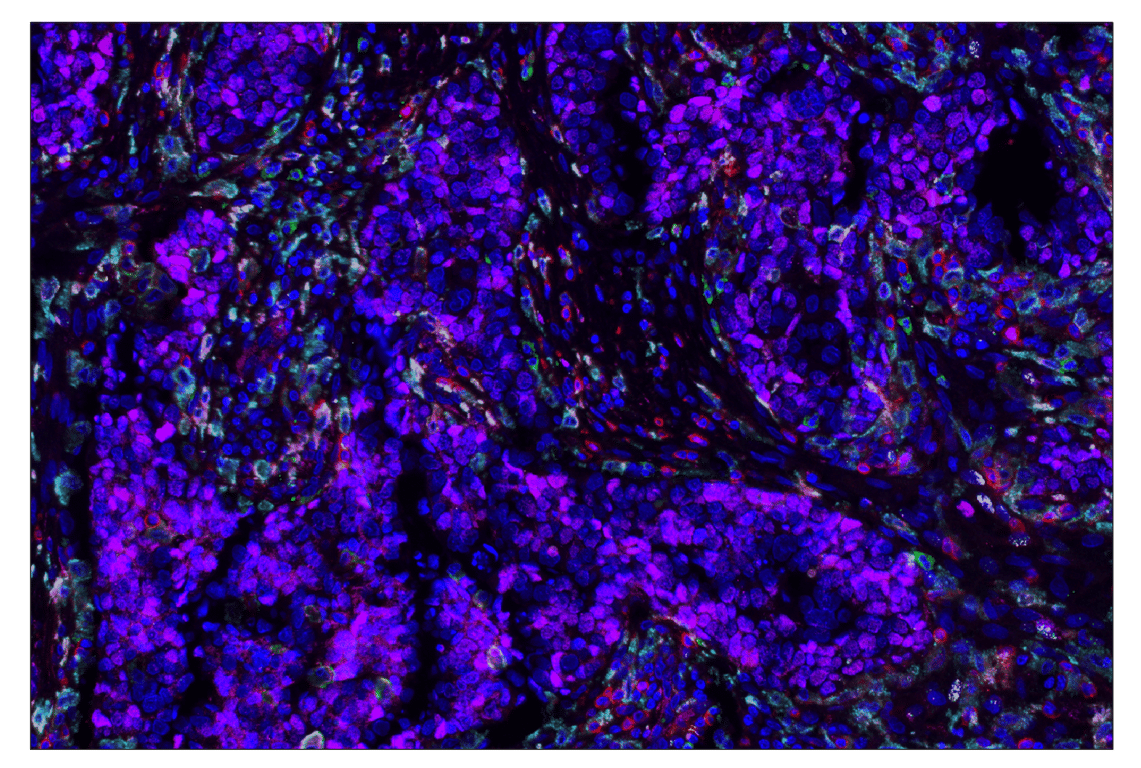 Immunohistochemistry Image 1: Ezh2 (D2C9) & CO-0167-594 SignalStar<sup>®</sup> Oligo-Antibody Pair