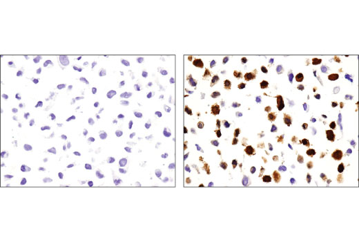 Immunohistochemistry Image 4: IDO (D5J4E<sup>™</sup>) Rabbit mAb