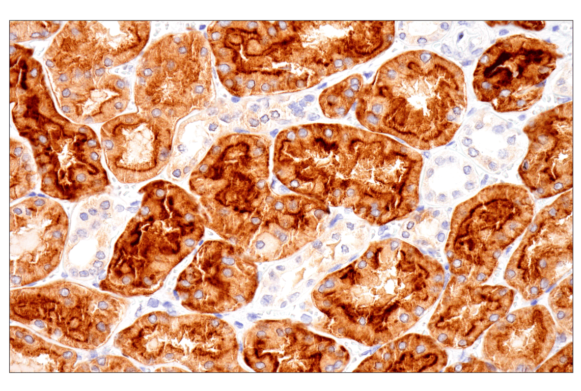 Immunohistochemistry Image 3: Folate Receptor Alpha/FOLR1 (BN3.2) Mouse mAb