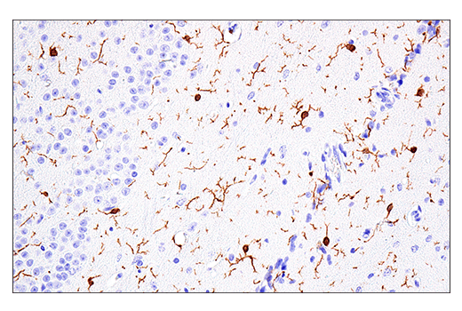 Immunohistochemistry Image 4: Iba1/AIF-1 (E4O4W) XP<sup>®</sup> Rabbit mAb (BSA and Azide Free)