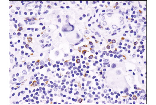 Immunohistochemistry Image 1: BLNK (D3P2H) XP<sup>®</sup> Rabbit mAb