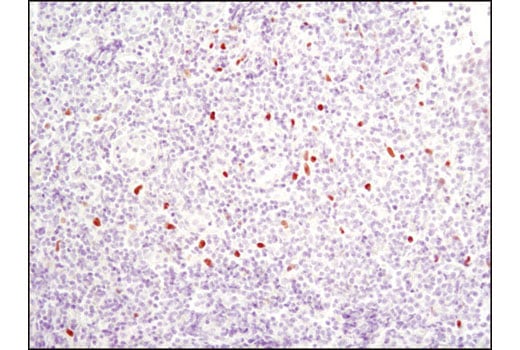 Immunohistochemistry Image 4: C/EBPα (D56F10) XP<sup>®</sup> Rabbit mAb (BSA and Azide Free)