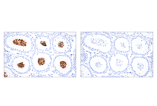 Immunohistochemistry Image 1: Ly6k (E4K8Y) XP<sup>®</sup> Rabbit mAb (BSA and Azide Free)