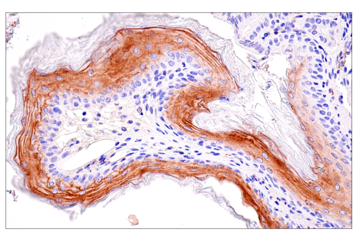 undefined Image 39: SARS-CoV-2 Virus-Host Interaction Antibody Sampler Kit