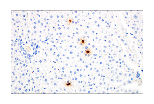 Immunohistochemistry Image 4: S100A9 (D3U8M) Rabbit mAb
