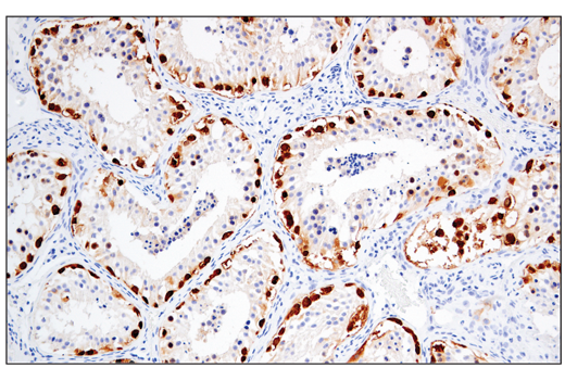 Immunohistochemistry Image 2: MAGE-A4 (E7O1U) XP<sup>®</sup> Rabbit mAb (BSA and Azide Free)