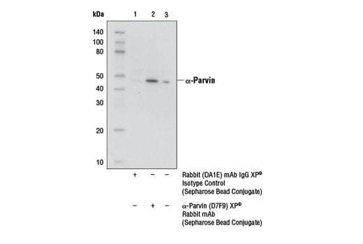 Immunoprecipitation Image 1: α-Parvin (D7F9) XP<sup>®</sup> Rabbit mAb (Sepharose<sup>®</sup> Bead Conjugate)