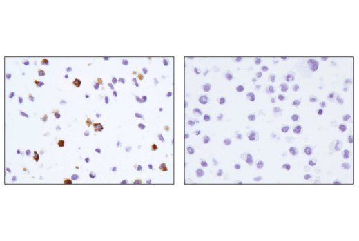 undefined Image 28: Human Reactive M1 vs M2 Macrophage IHC Antibody Sampler Kit