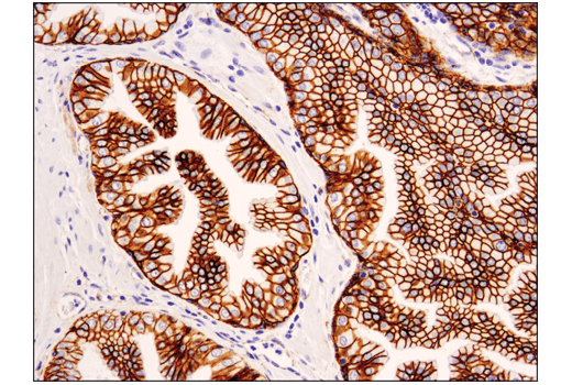 Immunohistochemistry Image 2: Catenin δ-1 (D7S2M) XP<sup>®</sup> Rabbit mAb