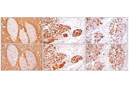 Immunohistochemistry Image 4: α-Synuclein (E4U2F) XP<sup>®</sup> Rabbit mAb (BSA and Azide Free)